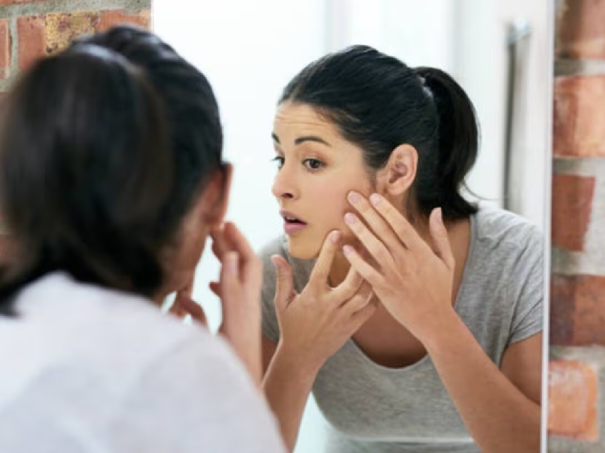 Stop Hiding These 5 Body Symptoms...They Could Be Signs of PMOS, Not Just Beauty Issues