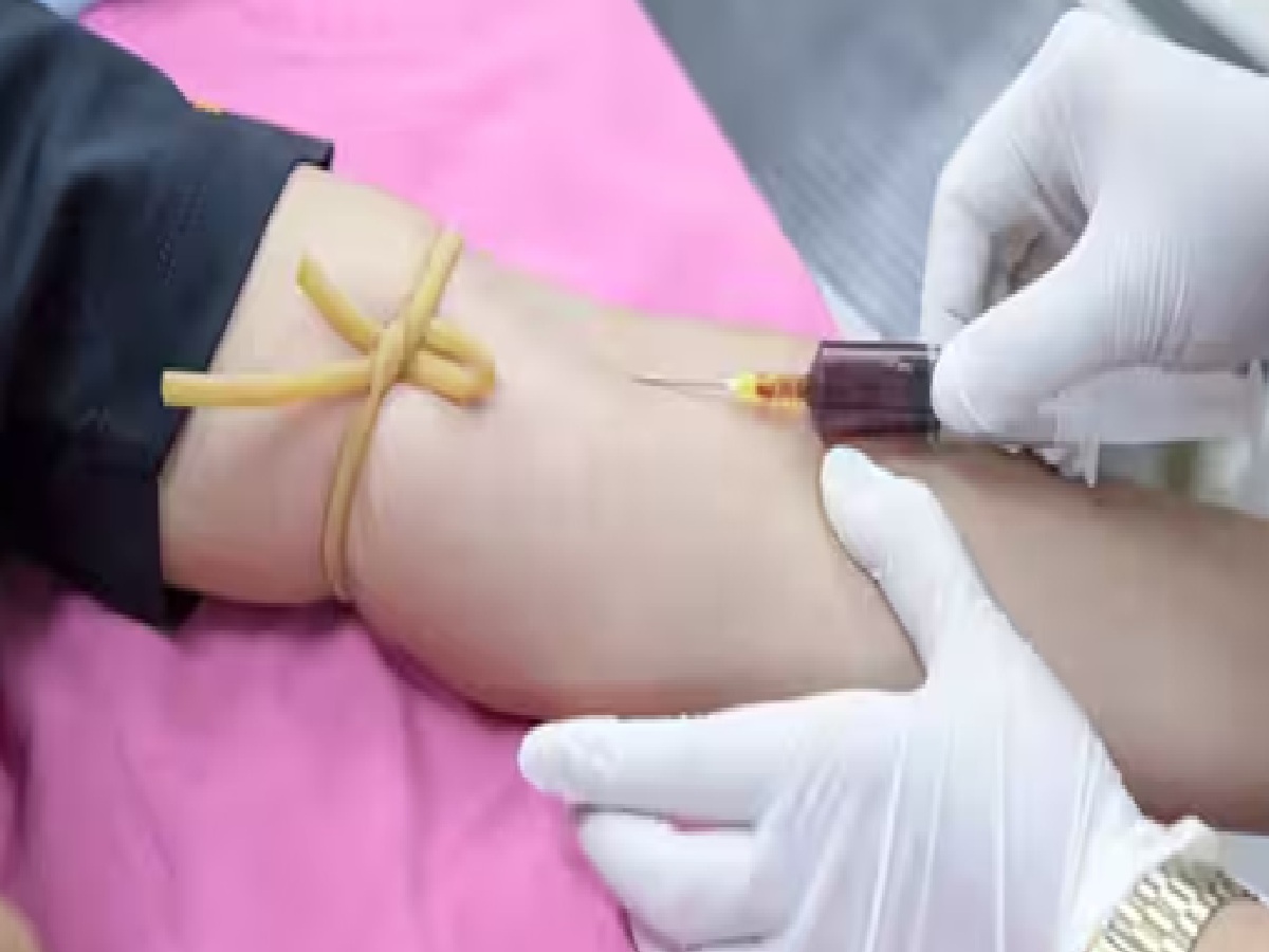 Annual Health Checkup: 5 Essential Tests That Can Save Your Life