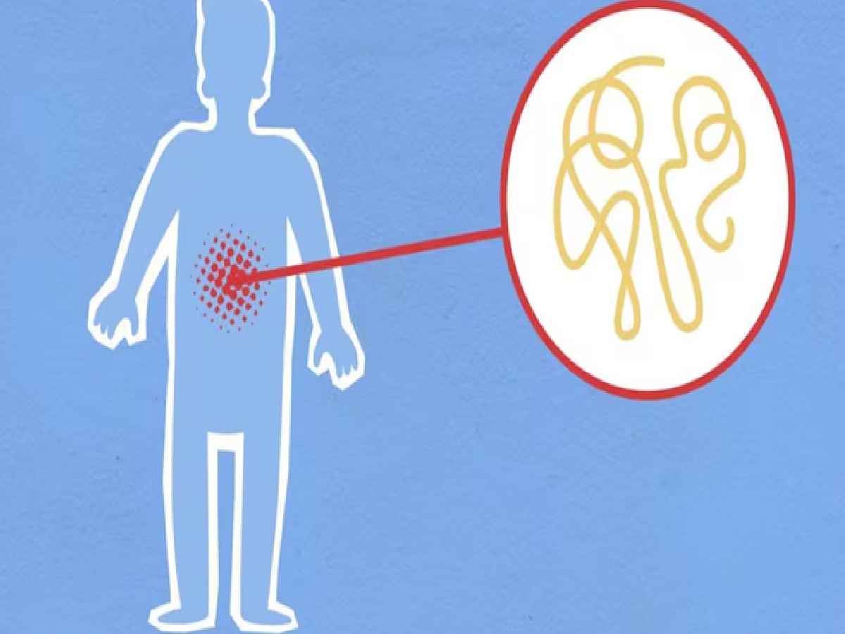 Monsoon Stomach Troubles: Stop These 4 Habits Today to Stay Healthy This Rainy Season