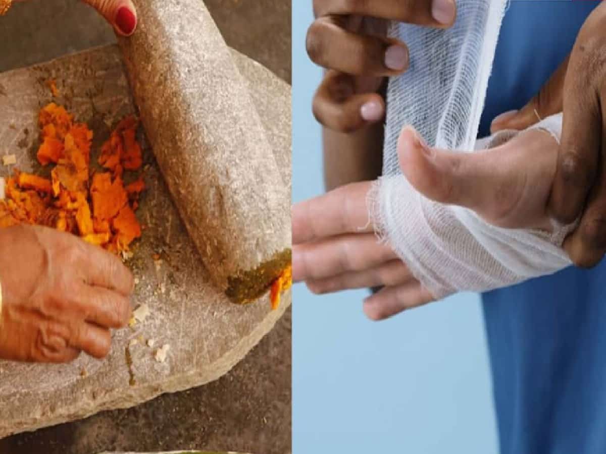 Turmeric for Wounds: Is Applying Haldi Safe for Every Cut, Here Is What Experts Say