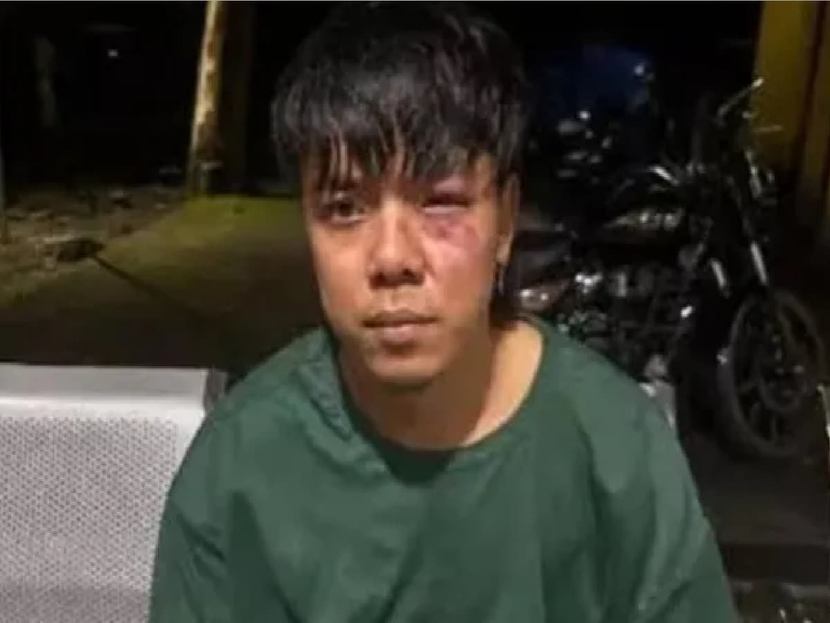 Sikkimese Rapper UNB Brutally Attacked in Arunachal Pradesh: Car Smashed with Iron Rods