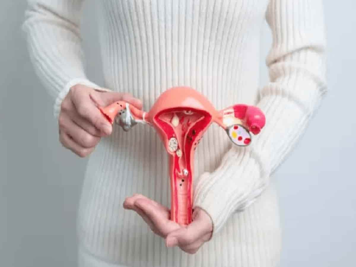 PCOS: Why Fatigue, Hair Fall, and Stubborn Acne 'PMOS' and How to Reverse It
