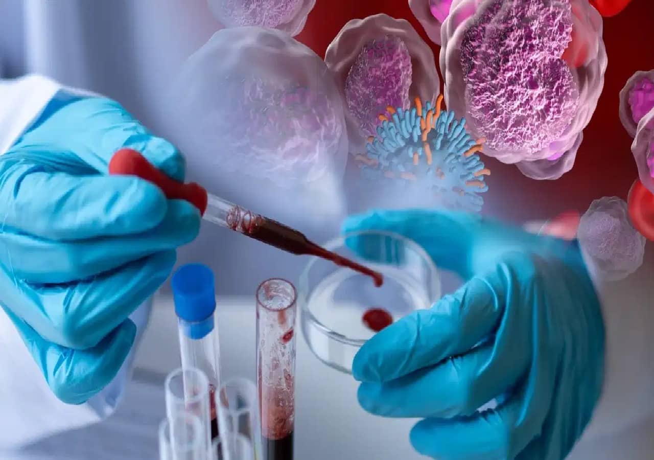 Can a Simple CBC Blood Test Catch Blood Cancer, Oncologist Explains the Reality