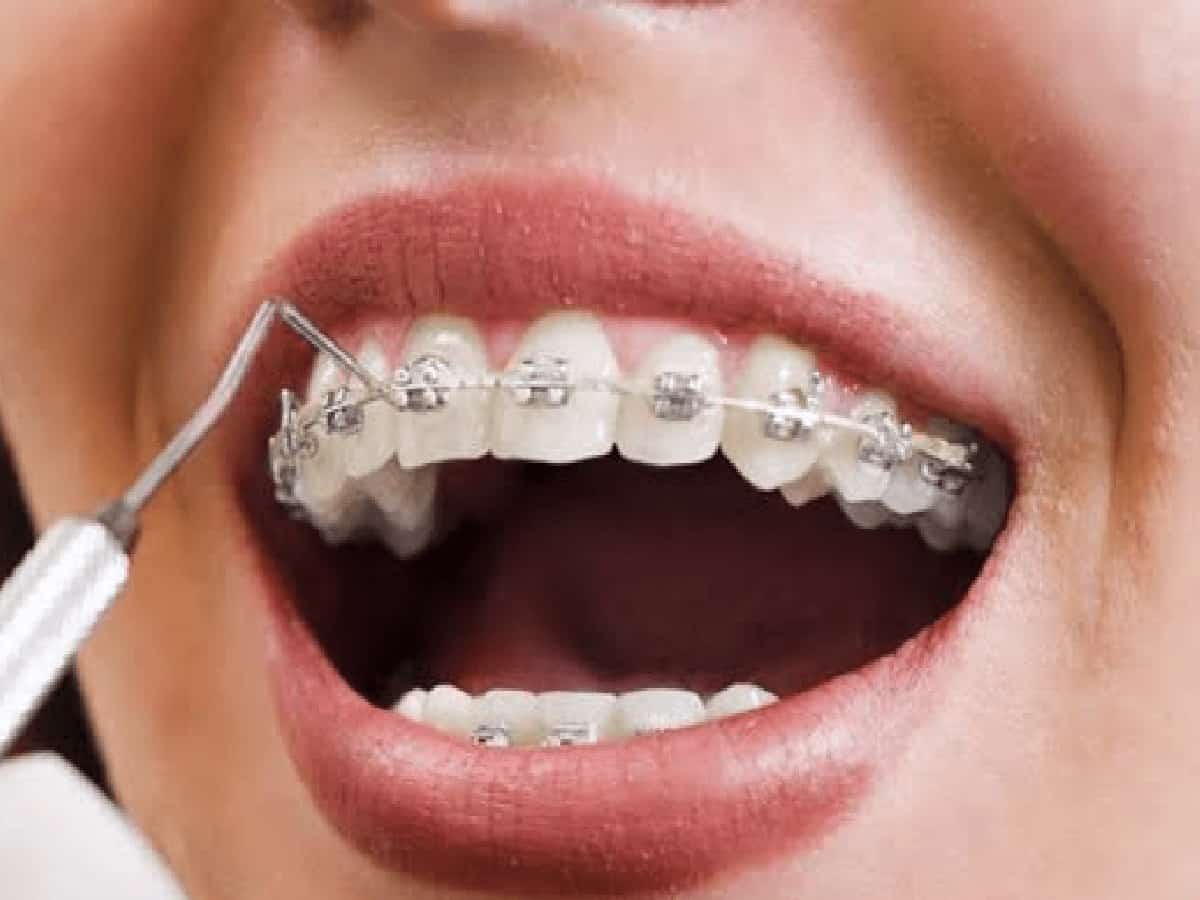 Natural Benefits, Enamel Risks, and the Right Way to Use Ancient Oral Twigs