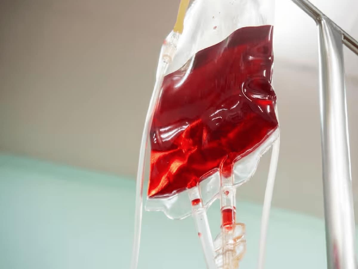 What Really Happens Inside the Human Body When the Wrong Blood Group Is Transfused