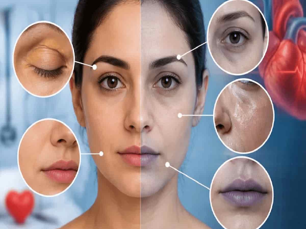5 Facial Changes That Signal Hidden Cardiovascular Trouble